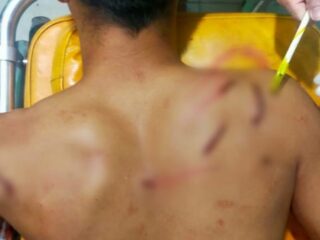 Diduga Masalah Asmara, Oknum Kiai Bacok Warga di Palengaan Pamekasan